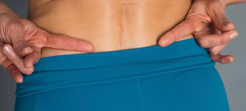 back pain.webp
